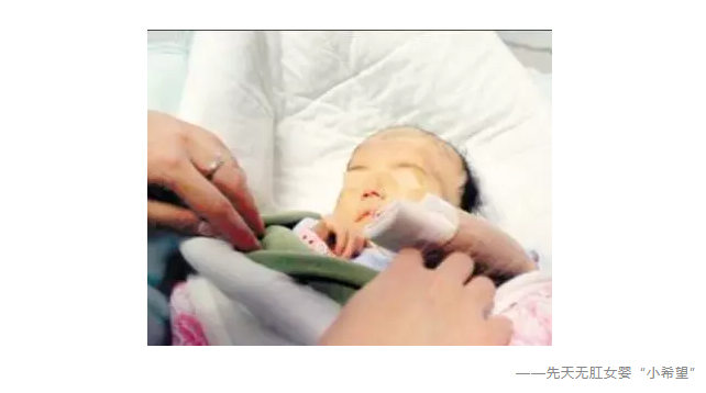 缺陷嬰兒適合什么保險？